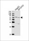 ZNF192 Antibody (Center)